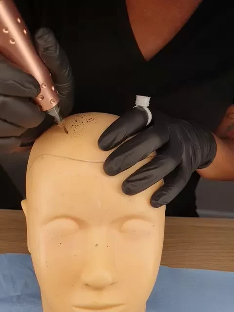 formation tricopigmentation - dermographie reparatrice