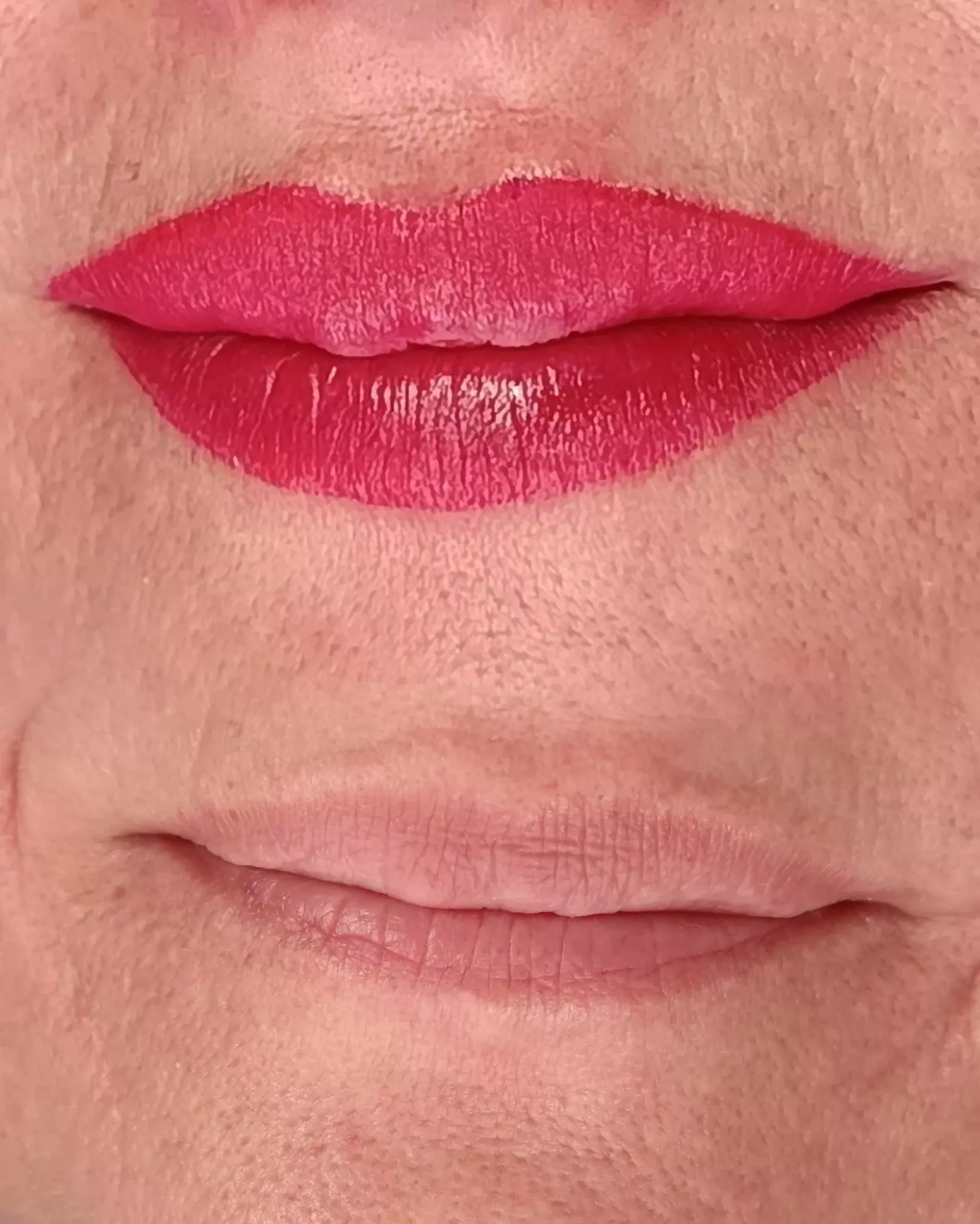 Formation Candy Lips - Résultat Avant / Après